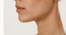 Mentoplastia Ósea
