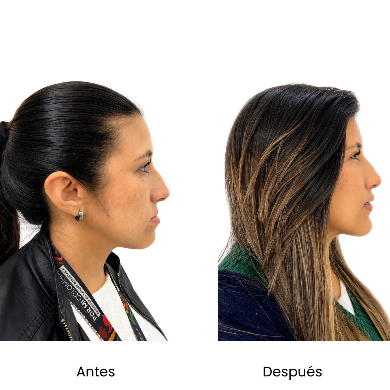 Retrato ilustrativo. No representa un caso clínico real.