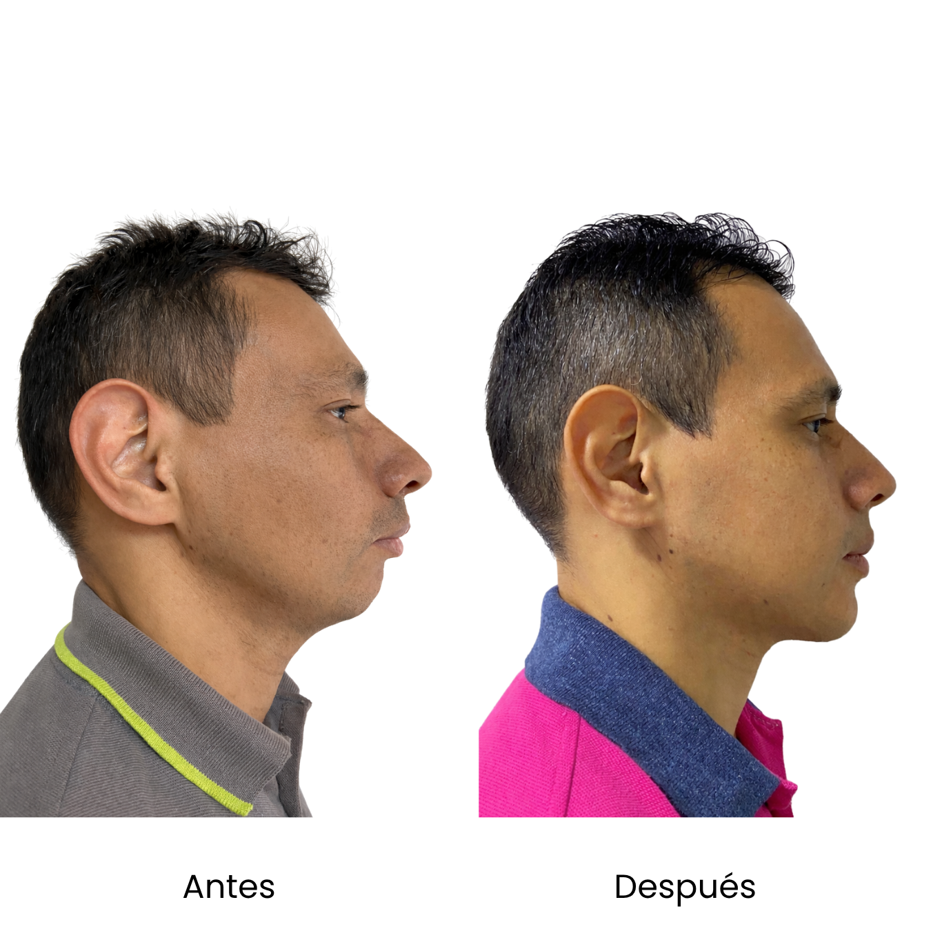 Retrato ilustrativo. No representa un caso clínico real.