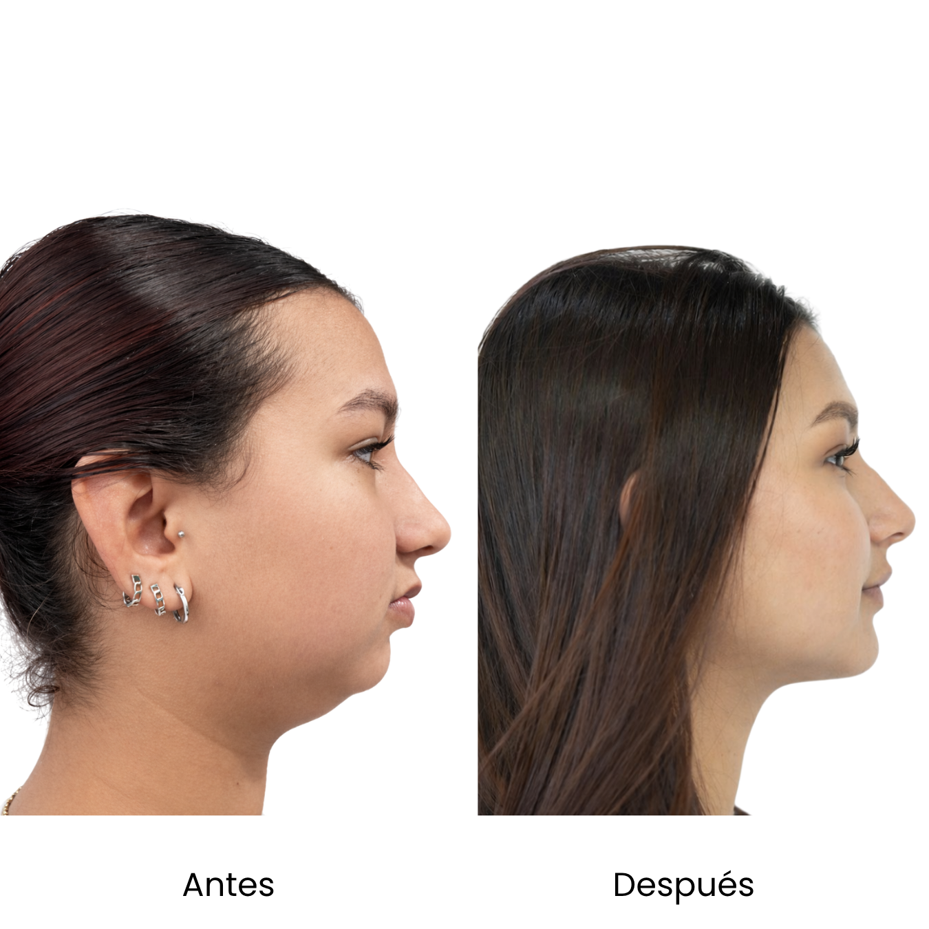 Retrato ilustrativo. No representa un caso clínico real.